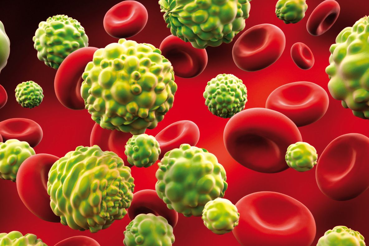 Probleme minore de sănătate care anunță instalarea cancerului