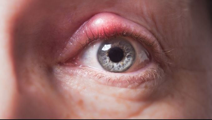 Cum scapi de URCIOR peste noapte