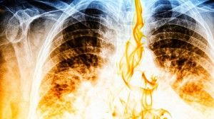 Atenţie, fumători! Aceasta este metoda UIMITOR de eficientă prin care îţi cureţi plămânii