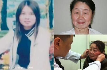 CUTREMURĂTOR: O boală rară o face să pară mai bătrână cu 40 de ani