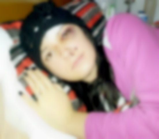 Tânără cântăreaţă, DESFIGURATĂ după ce a fost bătută pe stradă 