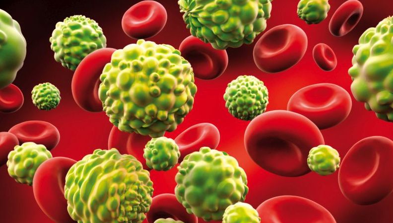 Aceasta este combinația alimentară anticancer ce poate fi preparată în casă!