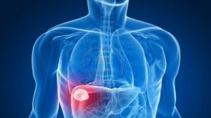 Semne mai puţin ştiute care îţi spun că ai probleme cu ficatul