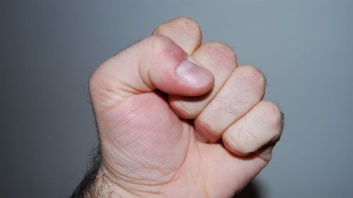 ŞOCANT. Încălcarea anumitor LEGI, un simptom al unei BOLI FĂRĂ LEAC