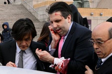 Ambasadorul american la Seul a fost rănit într-un atac de un bărbat înarmat cu o lamă de ras