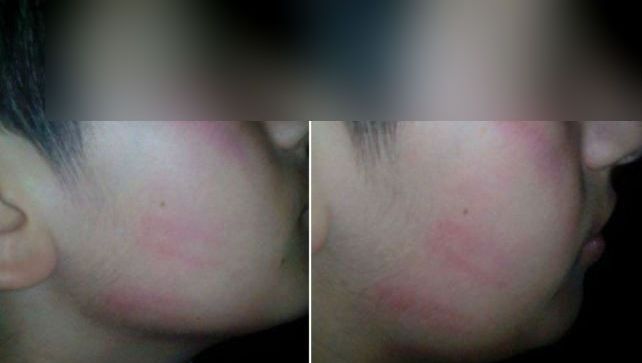 Ce a păţit profesorul de sport care a bătut un elev în timpul pauzei mari, la Amara