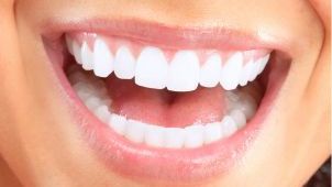 Albirea dinţilor acasă, în doar 3 minute! Cum se face