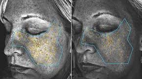 Băutura miraculoasă care opreşte apariţia ridurilor