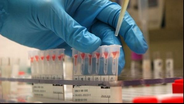 Greşeală în diagnosticarea cancerului. Poate conduce la un tratament greșit