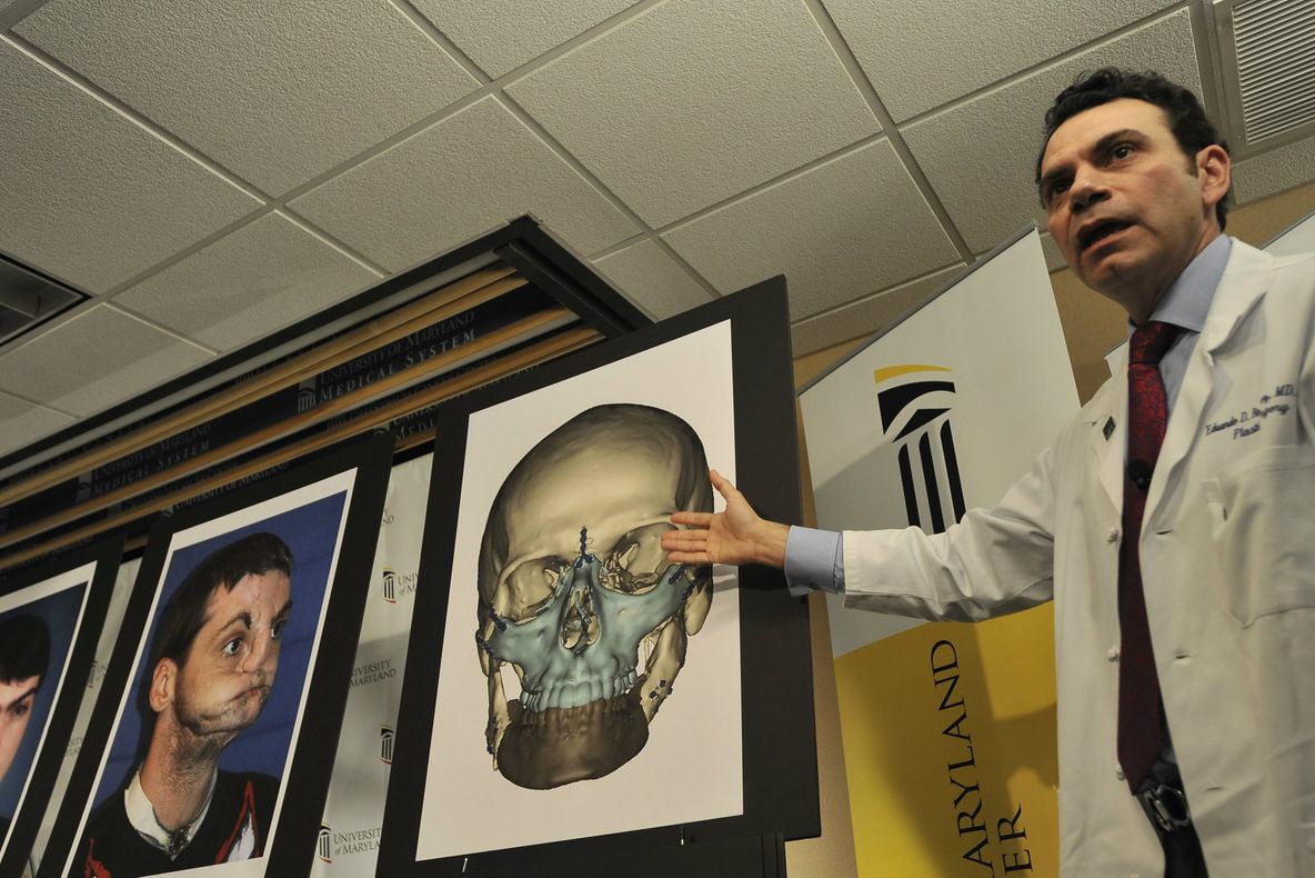 Un rus ar putea da peste cap medicina! De ce va fi cobai în primul transplant de cap!