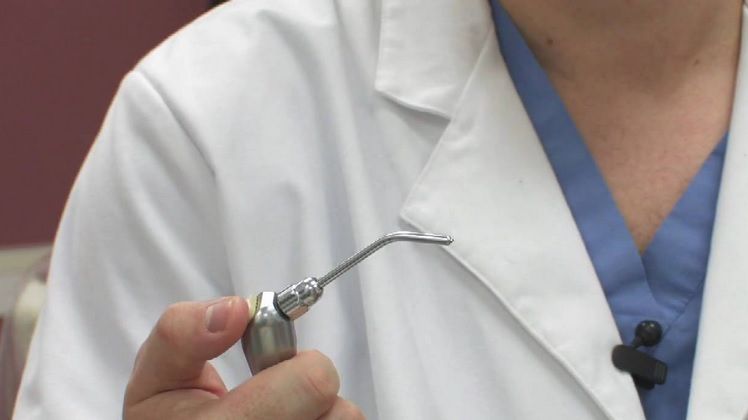 De frica dentistului, şi-a lipit singură dinţii cu super glue. Cum arată dantura femeii acum 