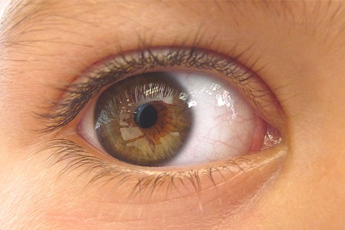 Ai probleme cu vederea? Iată remediul care reduce dioptriile şi regenerează ţesutul ocular!