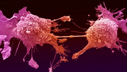 Descoperire. Un tratament revoluționar împotriva cancerului a dat rezultate excepționale