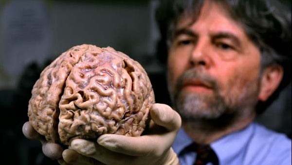 Creierul uman îmbătrâneşte cu opt ani după un accident vascular cerebral