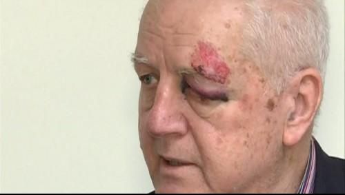 La un pas de moarte! Jean Pădureanu a căzut pe scări și-a fost dus de urgență la spital