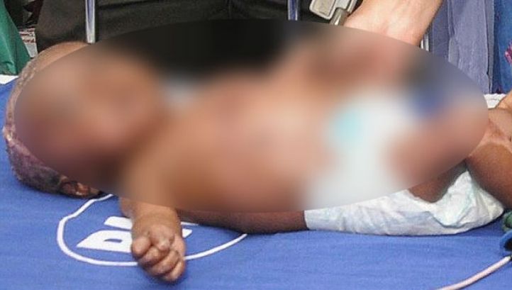 Cazul misterios al bebelușului care a luat foc din senin de patru ori 