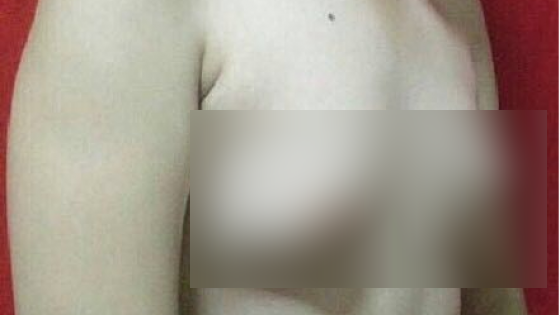 Un bărbat a descoperit că îi cresc sânii, după ce a mâncat asta 