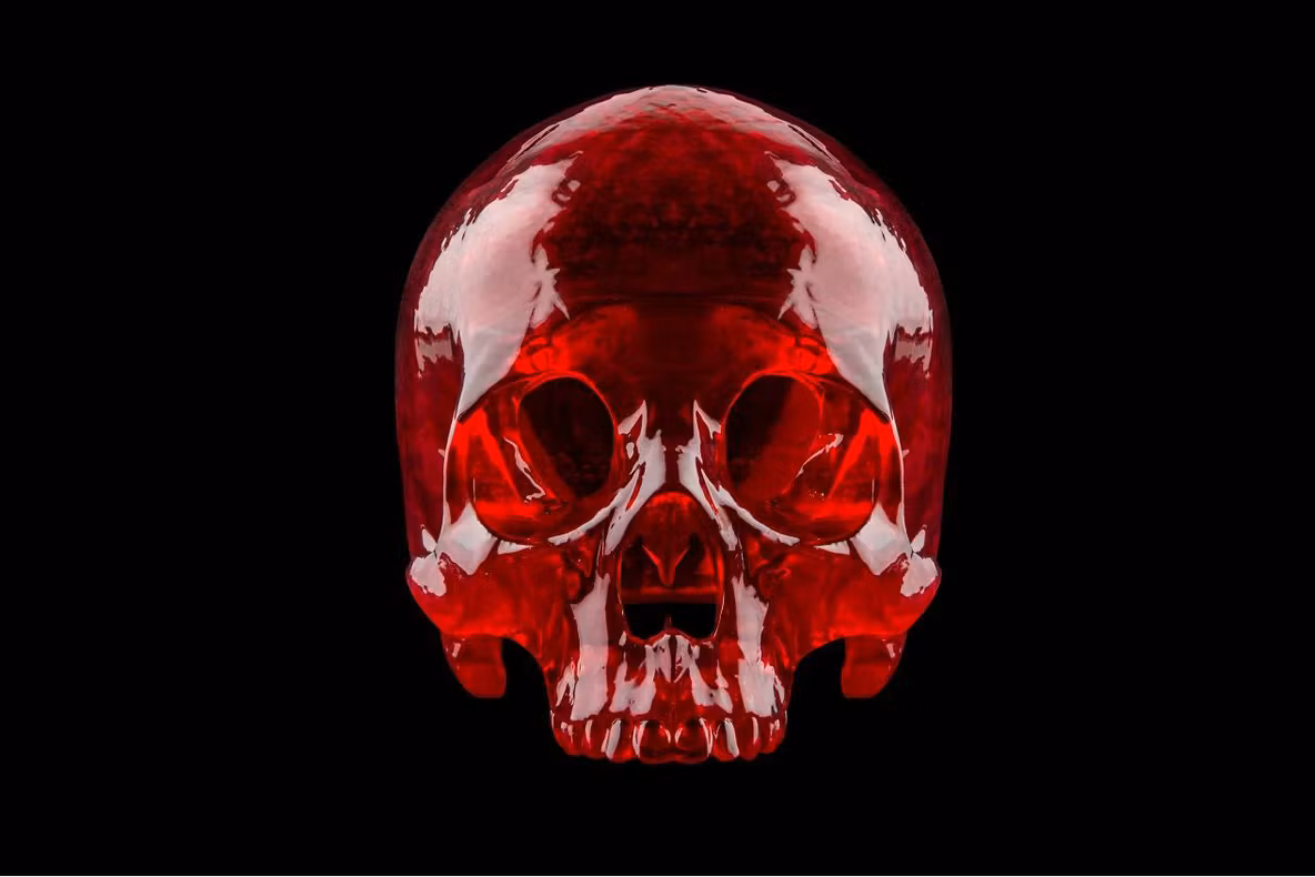 Nu ai să crezi cum arată craniul de om printat 3D! Operația care a salvat viața unui copil