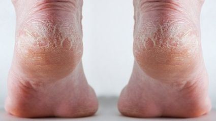 Repară-ţi călcâiele cu acest truc natural!