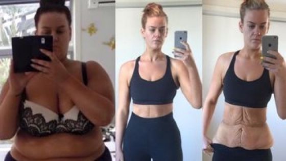 A slăbit peste 85 de kilograme în 11 luni. Un scandal a izbucnit după ce a publicat fotografia asta