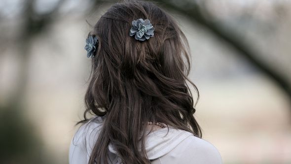 I se spune „fata dalmațian”. Cum arată tânăra cu mii de alunițe pe corp