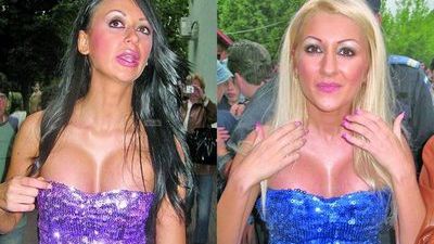 Drama Denisei de la Bambi. Buzele i-au fost distruse de operaţiile estetice. Ce a decis