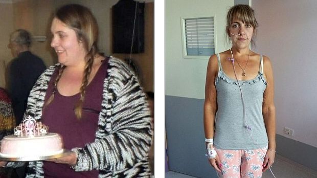 A slăbit 70 de kg, iar acum se luptă cu anorexia. Povestea femeii care mânca 100 de calorii pe zi