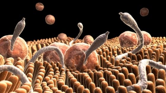 Mare atenție! Acestea sunt simptomele infecţiei cu paraziţi intestinali