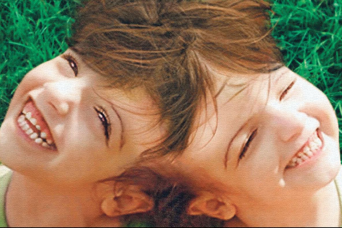 Povestea extraordinară a gemenelor siameze care văd și simt aceleași lucruri