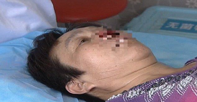 Fostul soț a mușcat-o de nas, apoi i l-a mâncat. Motivul bărbatului este uluitor