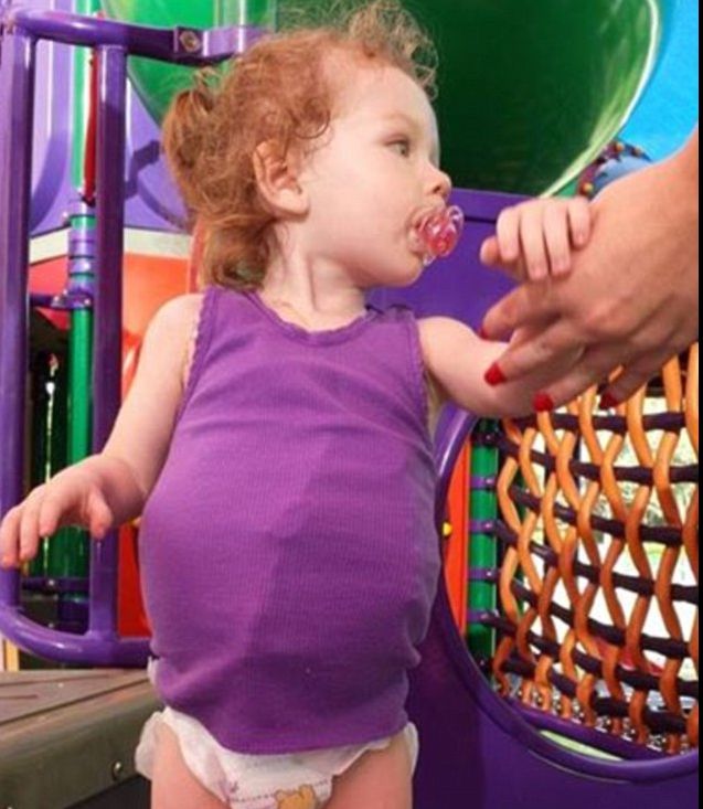 Părinții erau întrebați dacă micuța e gravidă. Te va șoca să afli ce are această fetiță în burtă 