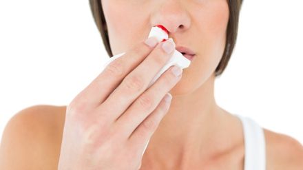 Sângerările nazale pot indica probleme de sănătate grave. Nu le ignora!