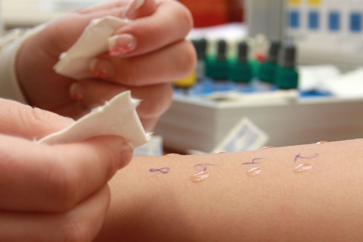 Cum îți dai seama de ce alergii suferi