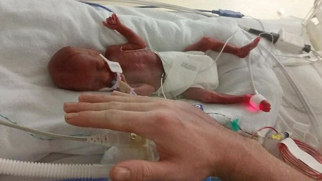 Când s-a născut, avea 500 de grame şi toţi credeau că va muri. Apoi, un miracol s-a petrecut