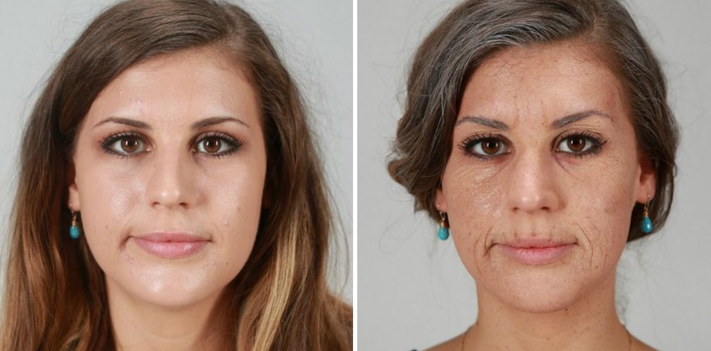 Ştiai ce urme îţi poate lăsa fumatul pe faţă? Trebuie să vezi asta! 