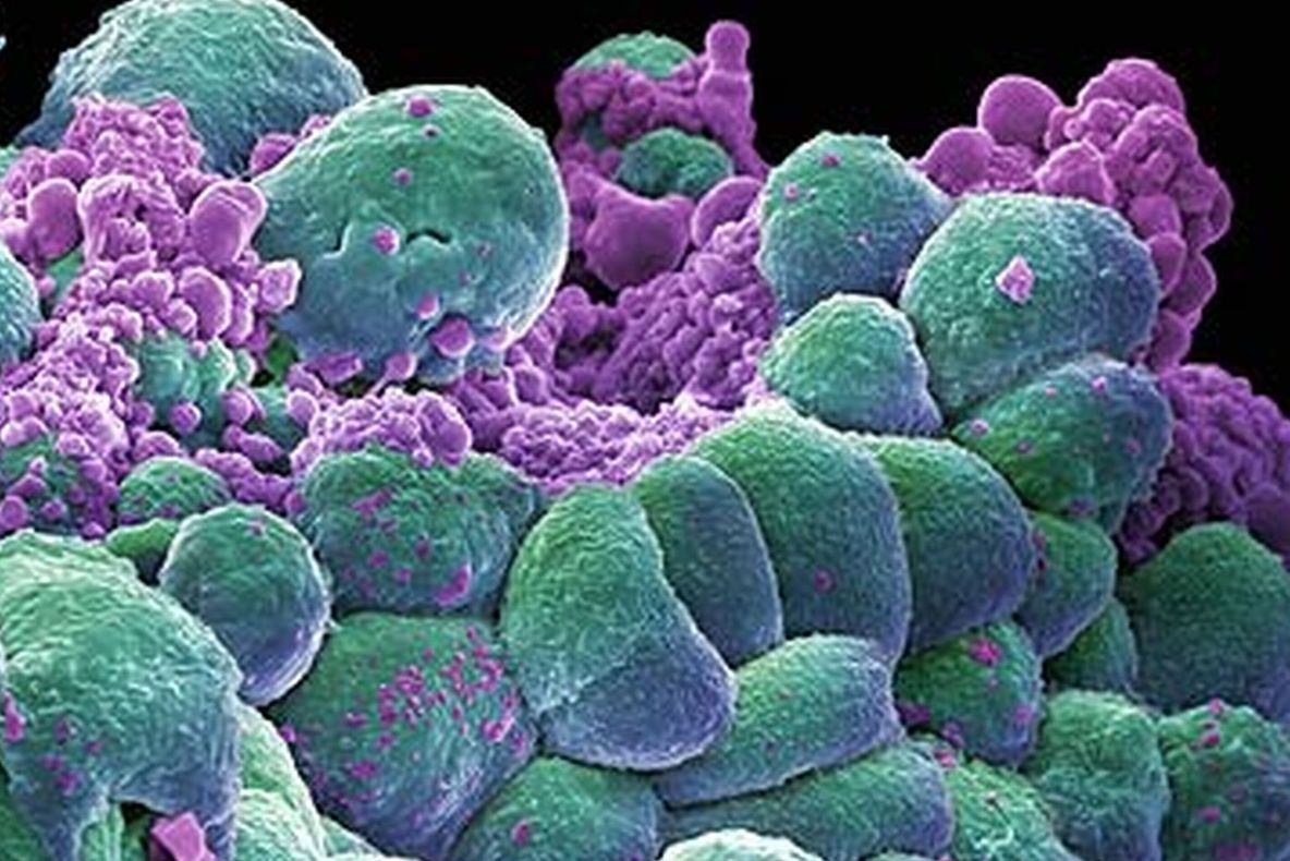 Medicii sunt uimiți. Leguma care te vindecă de cancer într-o singură zi