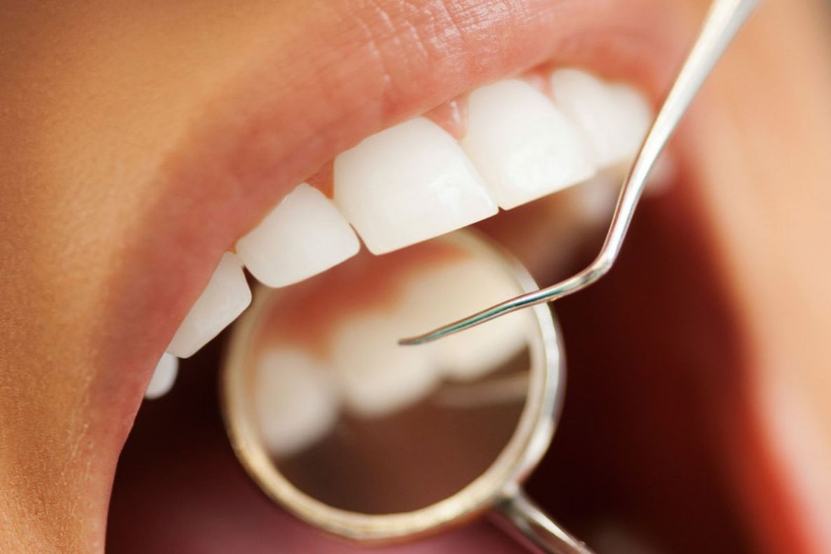 Prototipul care scoate durerea din cabinetul dentistului