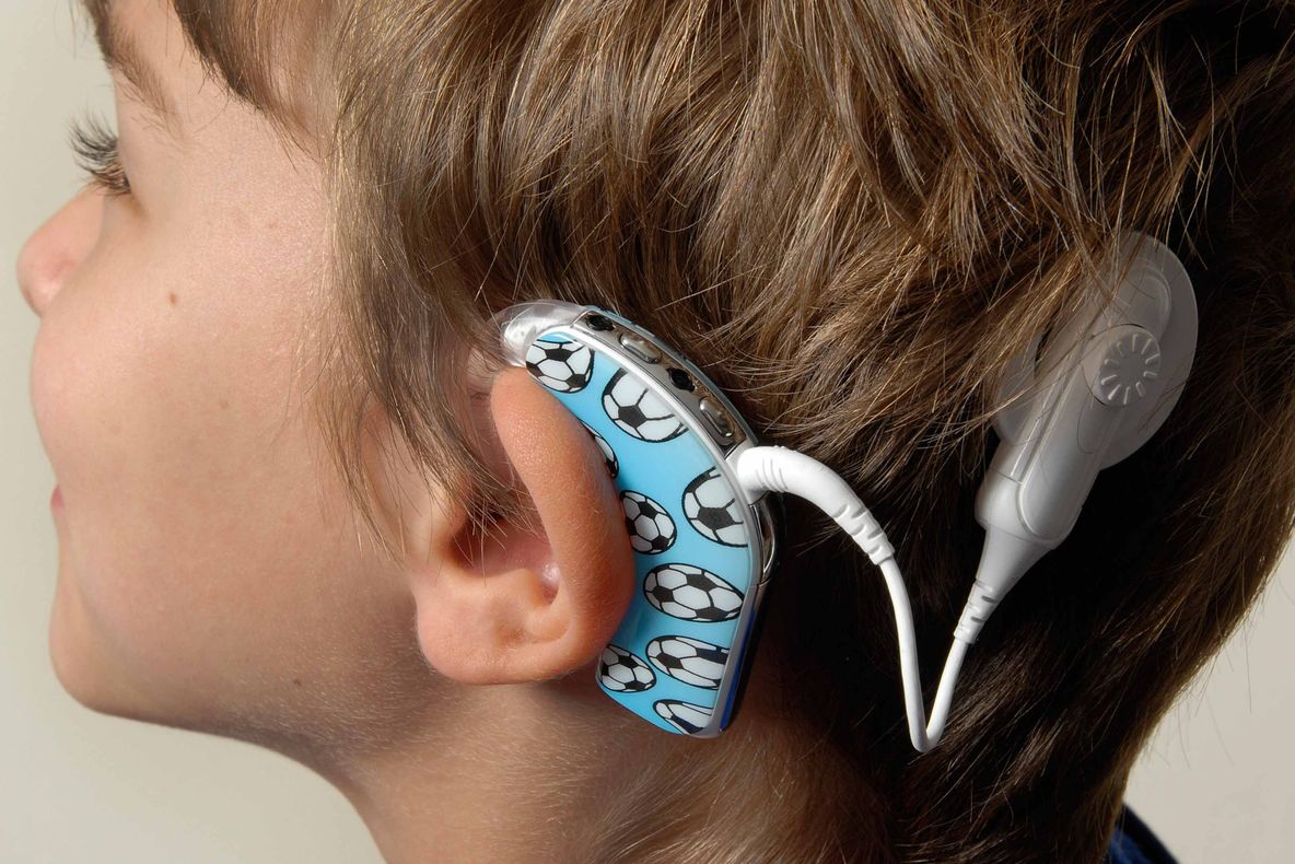 Bolnavii pot beneficia de implant cohlear bilateral decontat de casele de asigurări de sănătate
