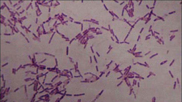 Și-a injectat o bacterie de 3,5 milioane de ani, găsită în permafrost. Ce a urmat este uimitor