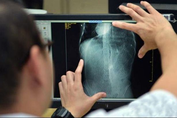 A mers la spital să se trateze de constipație. A muțit când a aflat ce purta în burtă de 10 ani