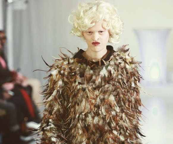 S-a născut fără dinţi, fără păr şi parţial oarbă. Cum a ajuns una dintre cele mai bine cotate modele