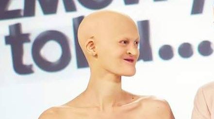 Când s-a născut, această fată a primit un diagnostic dur. Acum, povestea ei inspiră întreaga lume