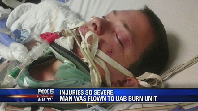 A ieşit în pauză să fumeze, dar ce s-a petrecut i-a schimbat viaţa. Acum nu poate mânca nimic