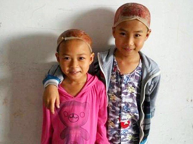 Gestul emoționant a 2 frățiori pentru tatăl care a suferit arsuri într-un accident. ”Sunt eroii mei”