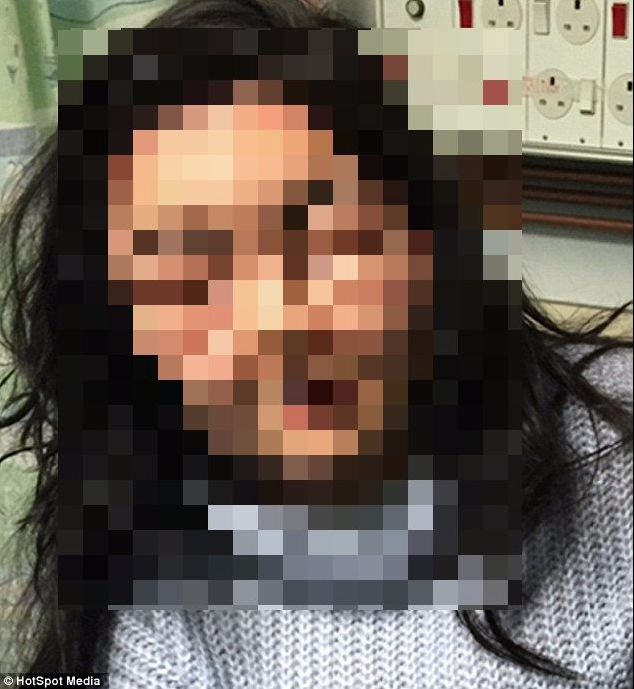 A rămas desfigurată după ce a folosit un produs cosmetic foarte comun. ”Arăt ca Frankenstein”