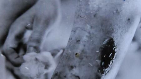 Bacteria "Morţii Negre". Ce trebuie să ştii despre această afecţiune 