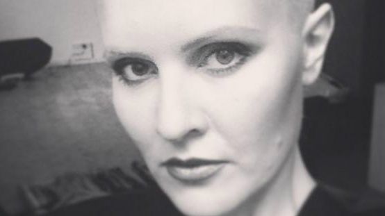 Vede o tumoră pe faţă când se uită în oglindă, dar aceasta nu există. Ce a păţit, de fapt, femeia