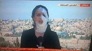 Apariţie şocantă la TV. Ce păţise această jurnalistă cu doar câteva clipe înainte