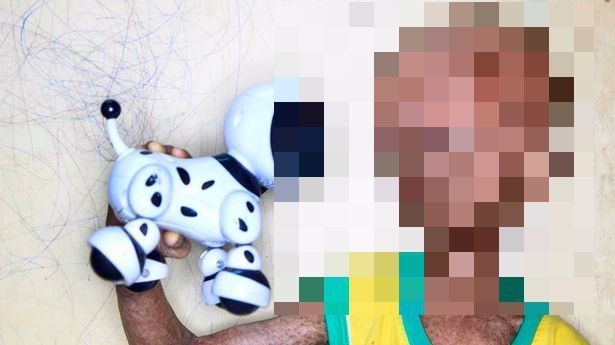 Are 14 ani, dar arată ca un pensionar. Adolescentul care îmbătrânește de 8 ori mai repede