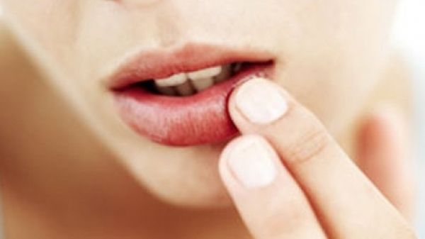 Ai buzele crăpate? Ce problemă de sănătate indică